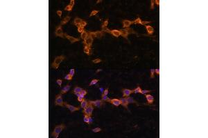 Immunofluorescence analysis of NIH/3T3 cells using PDGFRB antibody (ABIN3023138, ABIN3023139, ABIN3023140 and ABIN6219408) at dilution of 1:100.