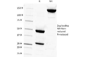 SDS-PAGE Analysis Purified PSA Mouse Monoclonal Antibody (1A7). (Prostate Specific Antigen anticorps)