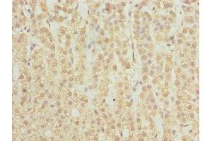 Immunohistochemistry of paraffin-embedded human adrenal gland tissue using ABIN7168896 at dilution of 1:100 (SPTLC2 anticorps  (AA 88-562))