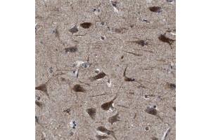 Immunohistochemical staining of human cerebral cortex with SLC35F1 polyclonal antibody  shows strong cytoplasmic positivity in neuronal cells at 1:500-1:1000 dilution. (SLC35F1 anticorps)