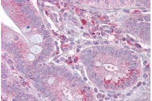 Anti-SLC13A2 antibody IHC staining of human small intestine.