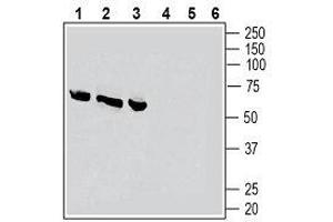 Western blot analysis of rat dorsal root ganglion lysates (lanes 1 and 4), rat lung membranes (lanes 2 and 5) and rat heart membranes (lanes 3 and 6): - 1-3. (CALCRL anticorps  (Extracellular))