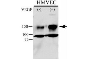 Phospho-KDR antibody used in western blot to detect phosphorylated KDR/FLK1 in HMVEC lysate.