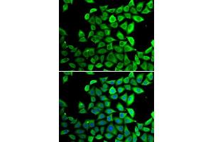 Immunofluorescence analysis of A-549 cells using PPID antibody.