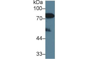Detection of LBP in Human Serum using Polyclonal Antibody to Lipopolysaccharide Binding Protein (LBP) (LBP anticorps  (AA 27-481))
