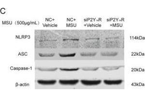 NLRP3 inflammasome activation was involved in P2Y14R deficiency.