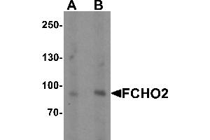 Western blot analysis of FCHO2 in rat heart tissue lysate with FCHO2 antibody at (A) 1 and (B) 2 µg/mL (FCHO2 anticorps  (Middle Region))