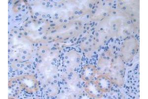 IHC-P analysis of Human Kidney tissue, with DAB staining. (CDCP1 anticorps  (AA 689-836))