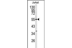 Western blot analysis of CDK8 antibody (N-term) (ABIN391759 and ABIN2841626) in Jurkat cell line lysates (35 μg/lane). (CDK8 anticorps  (N-Term))