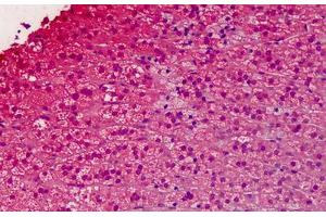 Human Adrenal: Formalin-Fixed, Paraffin-Embedded (FFPE)