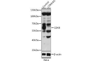 Western blot analysis of extracts from normal (control) and CDK8 knockout (KO) HeLa cells, using CDK8 antibody (ABIN6129240, ABIN6138329, ABIN6138330 and ABIN7101776) at 1:1000 dilution. (CDK8 anticorps  (AA 365-464))