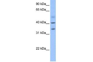 WB Suggested Anti-ZC3H14 Antibody Titration: 0. (ZC3H14 anticorps  (N-Term))