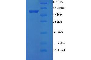 SDS-PAGE (SDS) image for Nuclear Receptor Subfamily 1, Group H, Member 3 (NR1H3) (AA 1-402), (Isoform 3) protein (His-SUMO Tag) (ABIN5711283)