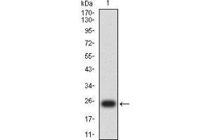 Western blot analysis using MLH1 mAb against human MLH1 (AA: 381-483) recombinant protein. (MLH1 anticorps  (AA 381-483))