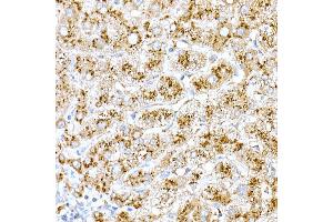 Immunohistochemistry of paraffin-embedded rat brain using Cathepsin D Rabbit pAb (ABIN6127553, ABIN6139223, ABIN6139224 and ABIN6217233) at dilution of 1:100 (40x lens). (Cathepsin D anticorps  (AA 65-412))