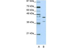 WB Suggested Anti-HNRPK Antibody Titration:  1. (HNRNPK anticorps  (C-Term))