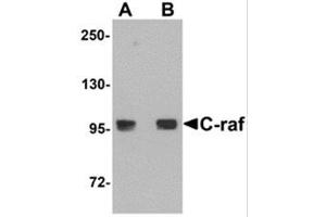 Western Blotting (WB) image for anti-V-Raf-1 Murine Leukemia Viral Oncogene Homolog 1 (RAF1) (N-Term) antibody (ABIN781705) (RAF1 anticorps  (N-Term))