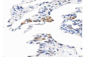 ABIN6268821 at 1/100 staining human Lung tissue sections by IHC-P. (CYB5A anticorps  (Internal Region))