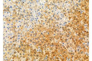 ABIN6262115 and ABIN6276777 at 1/100 staining Rat liver tissue by IHC-P.