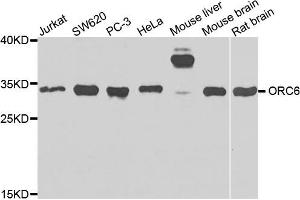 Western blot analysis of extracts of various cells, using ORC6 antibody. (ORC6 anticorps)