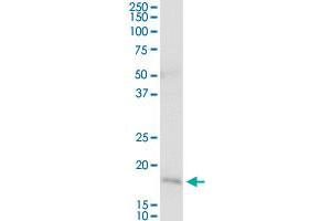 NNT MaxPab rabbit polyclonal antibody.