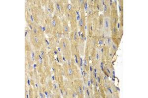 Immunohistochemistry of paraffin-embedded mouse heart using PLCG2 antibody.