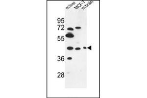 Western blot analysis of PSG3 Antibody (N-term) in MCF-7 cell line and Mouse liver, brain tissue lysates (35ug/lane).