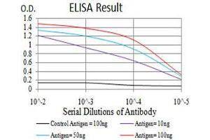 Black line: Control Antigen (100 ng),Purple line: Antigen (10 ng), Blue line: Antigen (50 ng), Red line:Antigen (100 ng)