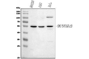 Western blot analysis of TNFRSF11B using anti-TNFRSF11B antibody (ABIN7600875).