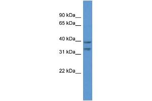 WB Suggested Anti-BRMS1L Antibody Titration: 1. (BRMS1L anticorps  (C-Term))