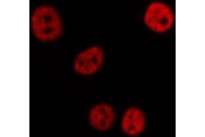 ABIN6276993 staining  Hela cells by IF/ICC. (RPL5 anticorps  (Internal Region))