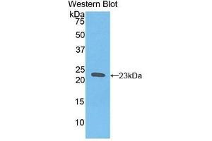 Western Blotting (WB) image for anti-Hemoglobin beta (HBB) (AA 1-147) antibody (ABIN1175984) (Hemoglobin Subunit beta anticorps  (AA 1-147))