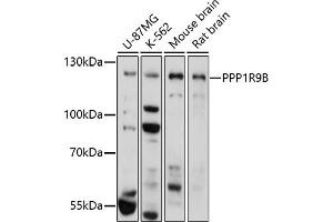 Western blot analysis of extracts of various cell lines, using PPP1R9B antibody (ABIN7269680) at 1:1000 dilution.
