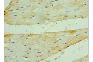 Immunohistochemistry of paraffin-embedded human skeletal muscle tissue using ABIN7142006 at dilution of 1:100