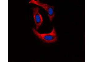 Immunofluorescent analysis of Ryanodine Receptor 2 (pS2808) staining in U251 cells.