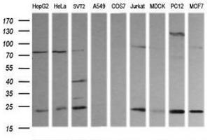 Image no. 3 for anti-RAB30, Member RAS Oncogene Family (RAB30) antibody (ABIN1500559)