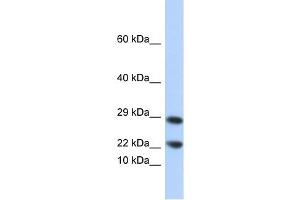 Lipocalin 8 antibody used at 1 ug/ml to detect target protein. (LCN8 anticorps  (N-Term))