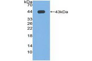 Figure. (Phospholipase D anticorps  (AA 725-1074))