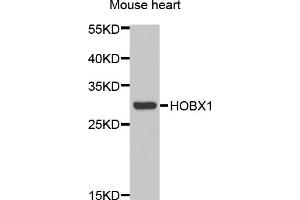 Western blot analysis of extracts of mouse heart, using HOXB1 antibody.