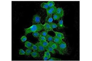 IF analysis of BubR1/BUB1B using anti-BubR1/BUB1B antibody (ABIN7600960).