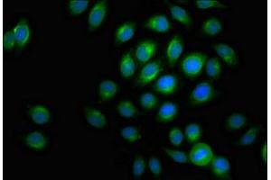 Immunofluorescent analysis of A549 cells using ABIN7175433 at dilution of 1:100 and Alexa Fluor 488-congugated AffiniPure Goat Anti-Rabbit IgG(H+L)