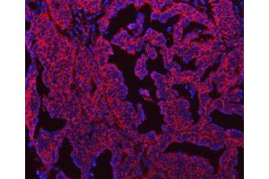 IF analysis of SEPT7/SEPTIN7 using anti-SEPT7/SEPTIN7 antibody (ABIN7599301). (Septin 7 anticorps  (AA 1-351))