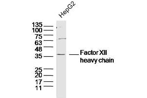 Human HepG2 cells probed with Factor XII heavy chain Polyclonal Antibody, unconjugated  at 1:300 overnight at 4°C followed by a conjugated secondary antibody at 1:10000 for 90 minutes at 37°C. (Factor 12 Heavy Chain (F12) anticorps)