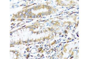 Immunohistochemistry of paraffin-embedded Human stomach using HLA-DPB1 Polyclonal Antibody at dilution of 1:100 (40x lens). (HLA-DPB1 anticorps)