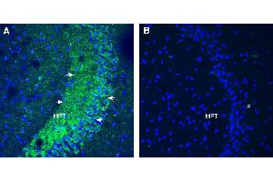 Expression of Orai2 in mouse cerebellum. (ORAI Calcium Release-Activated Calcium Modulator 2 (ORAI2) Peptide)