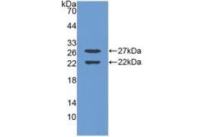 Western blot analysis of recombinant Mouse EGR1. (EGR1 anticorps  (AA 273-431))