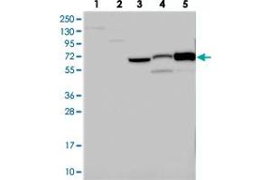 Western blot analysis of Lane 1: RT-4, Lane 2: U-251 MG, Lane 3: Human Plasma, Lane 4: Liver, Lane 5: Tonsil with CNNM1 polyclonal antibody .