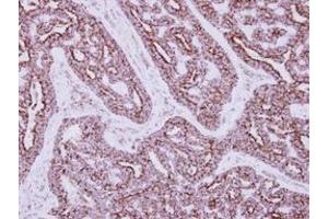 Image no. 1 for anti-3-hydroxyisobutyrate Dehydrogenase (HIBADH) (AA 1-257) antibody (ABIN1501919)