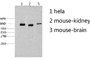 Western blot analysis of 1) Hela, 2) mouse kidney, 3) mouse brain, diluted at 1:2000. (Cytokeratin 7 anticorps)