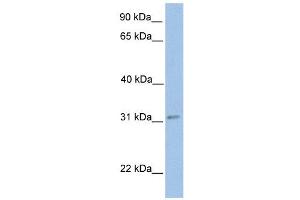 ECHDC2 antibody used at 1 ug/ml to detect target protein. (ECHDC2 anticorps  (Middle Region))